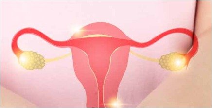 uterus - Cervical cancer- menstrual periods