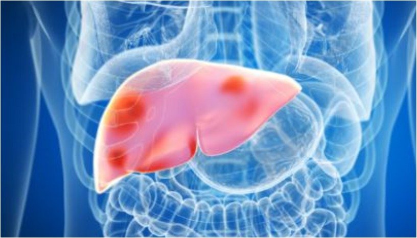 Health Tips - Liver 3